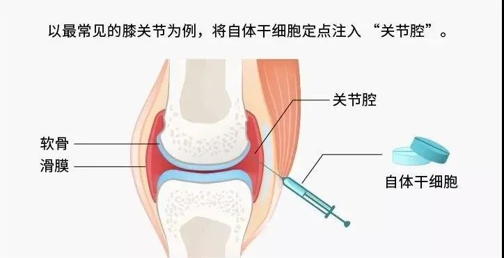 一半的致殘率！這個小毛病人人值得警惕！(圖7)