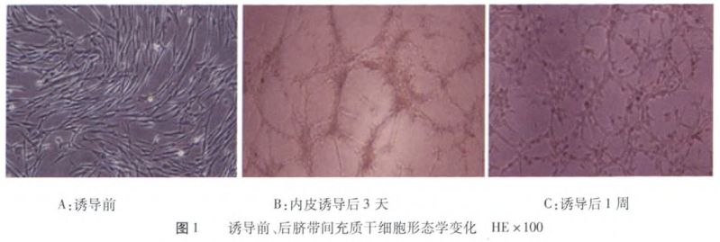 體檢中最易被忽視的第五“高”，竟是動(dòng)脈硬化的元兇？(圖12)