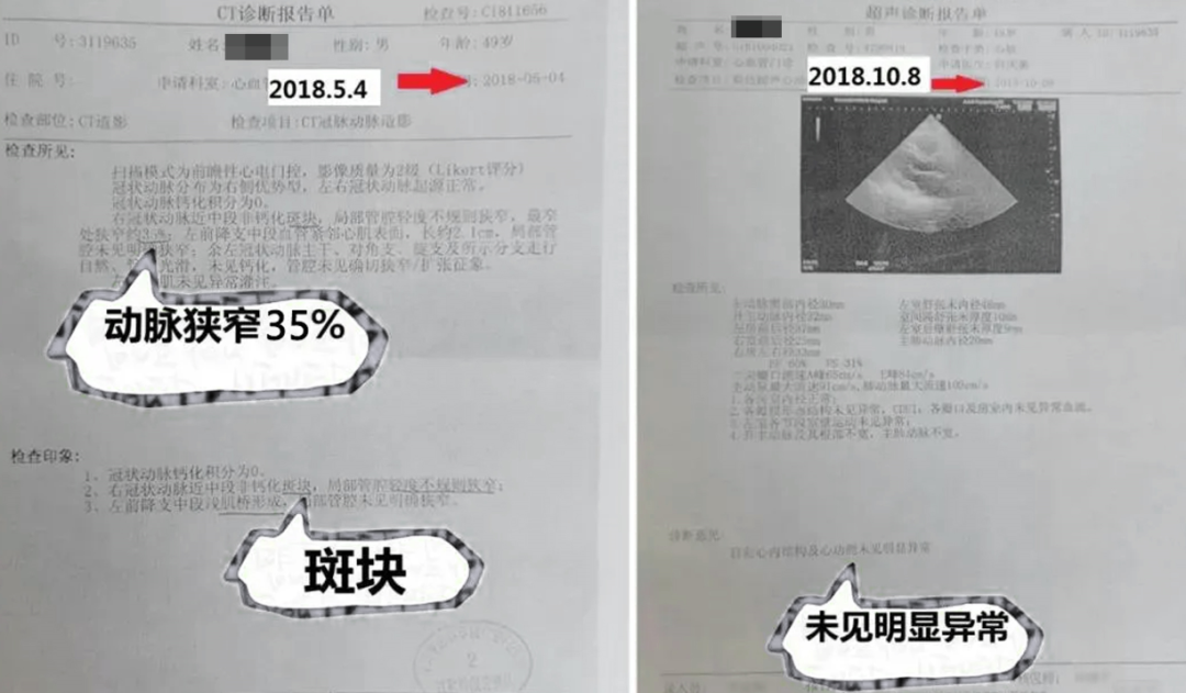 真實(shí)案例：上億個(gè)干細(xì)胞進(jìn)入心臟受損區(qū)域后，他的心臟病......(圖6)
